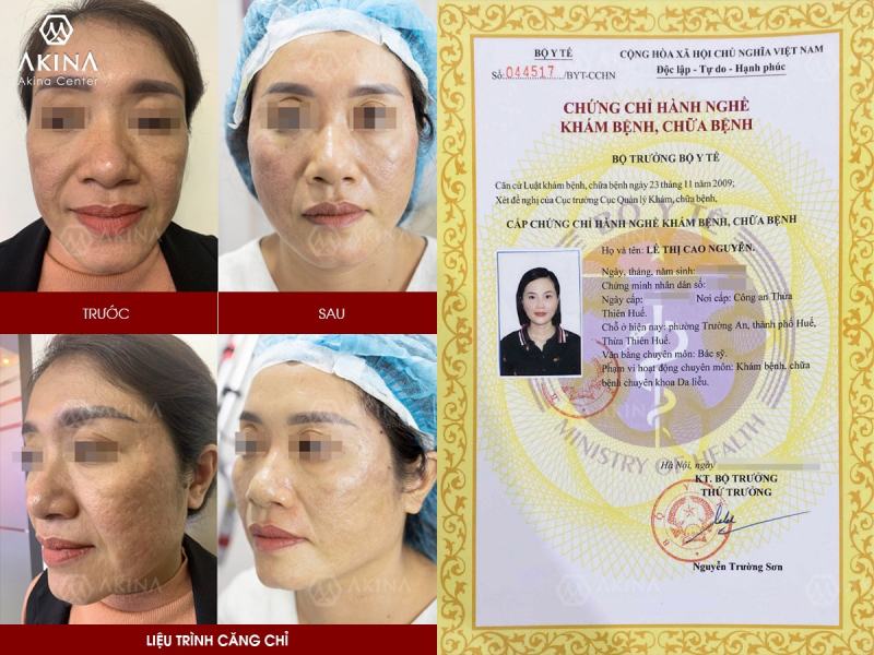 THS. BÁC SĨ LÊ CAO NGUYÊN – THS. BS DA LIỄU THẨM MỸ NỘI KHOA